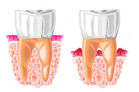 This is Service Periodontal Treatment